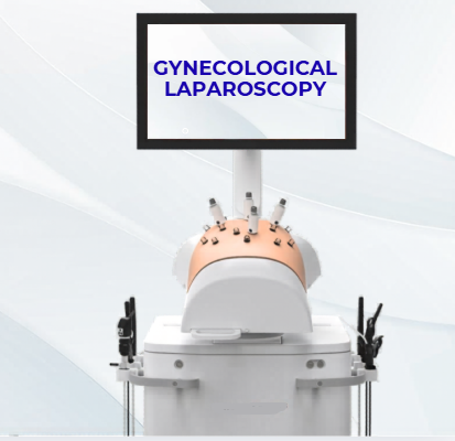Gynecological Laparoscopy